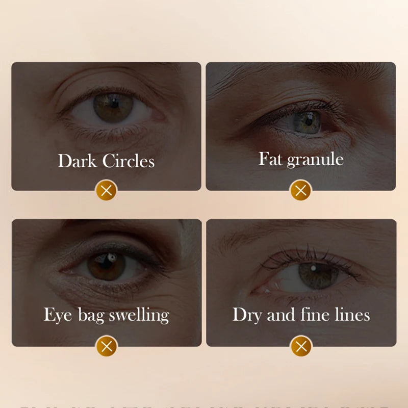 Snake Venom & Caffeine Eye Cream for Dark Circles