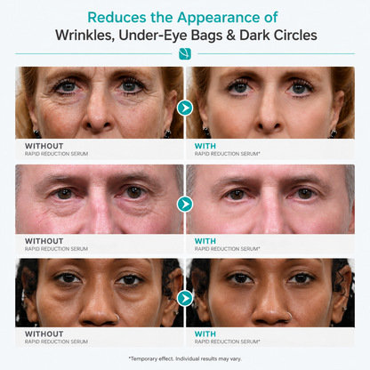 Plexaderm Rapid Eye Lift Serum