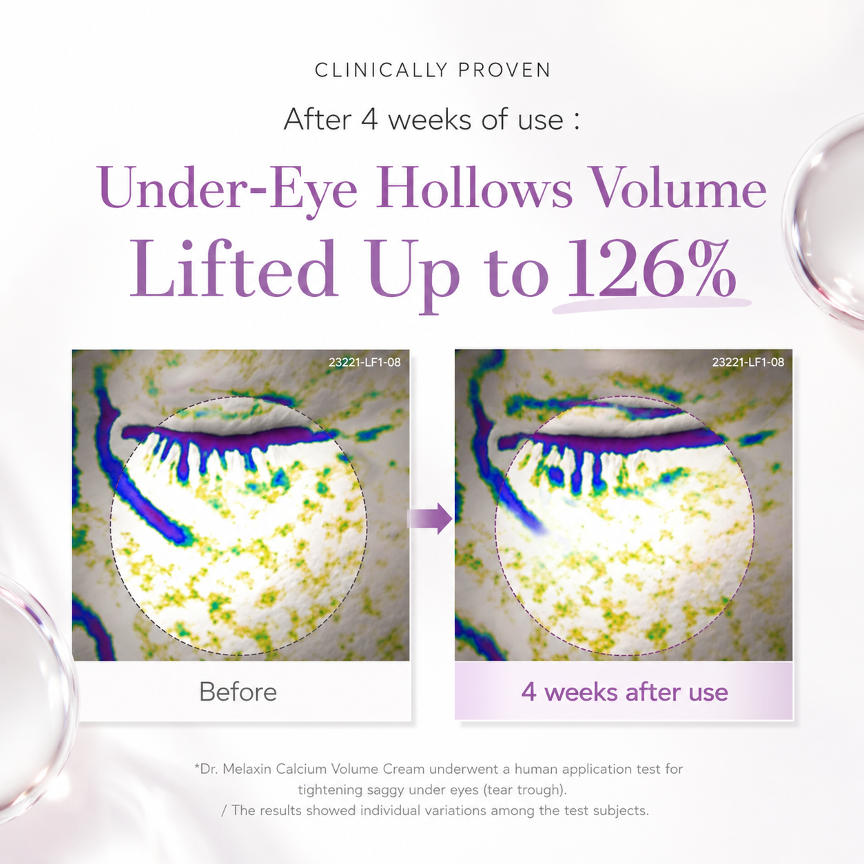 Dr. Melaxin Calcium Intense Volume Eye Cream