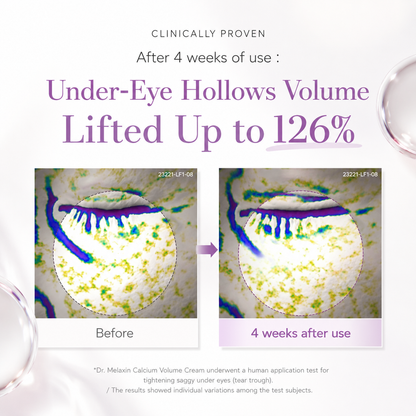 Dr. Melaxin Calcium Intense Volume Eye Cream